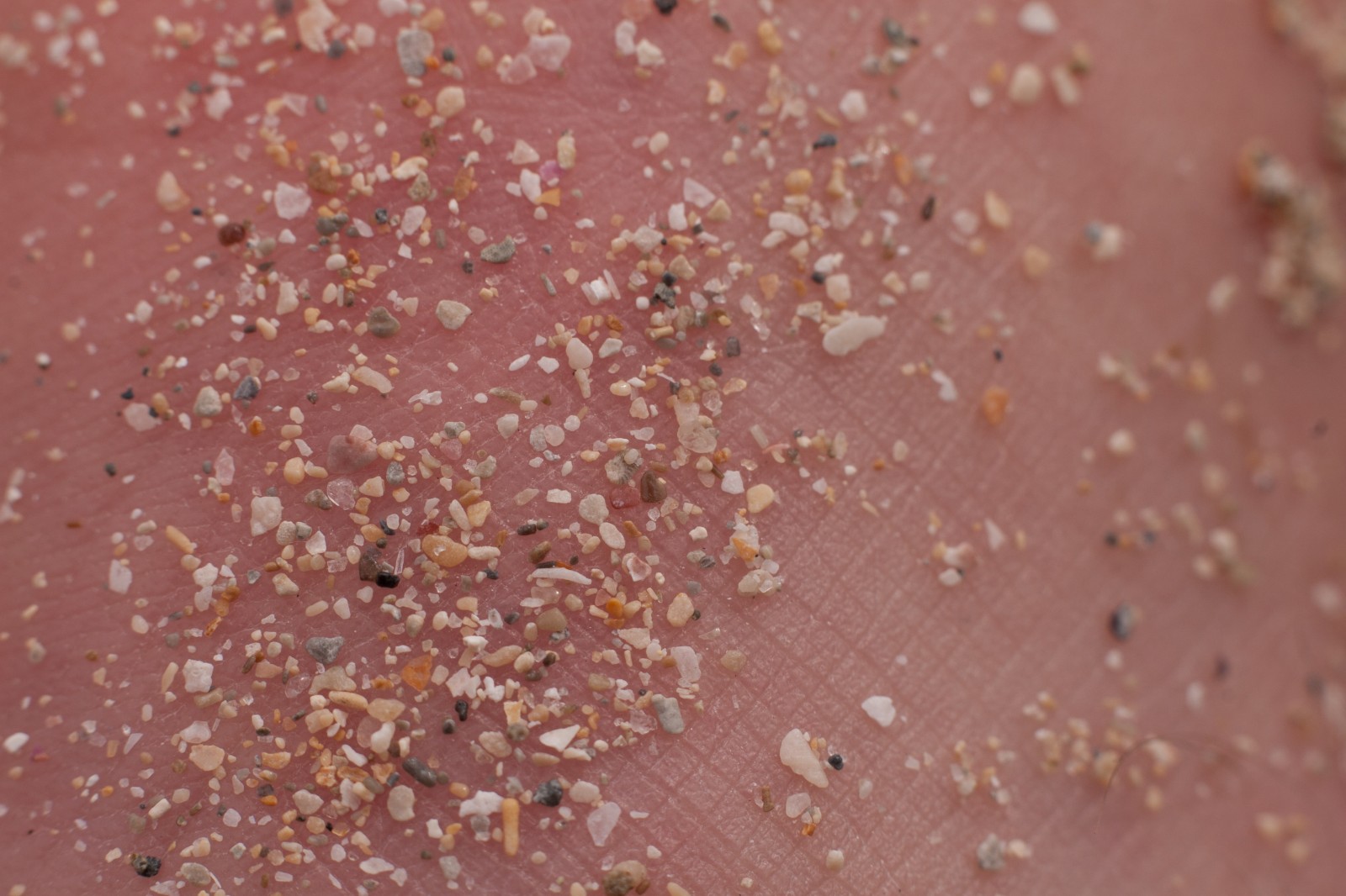 skin coated in sand